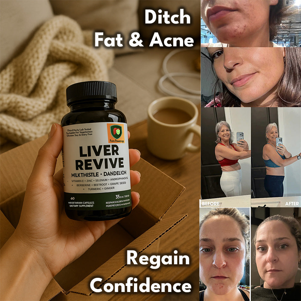 Liver Revive - Fights Fat, Acne & Dull Skin